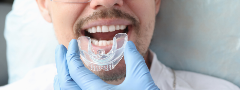 oral appliance osa